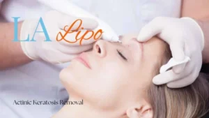 Woman receiving Actinic Keratosis Removal Treatment Uttoxeter