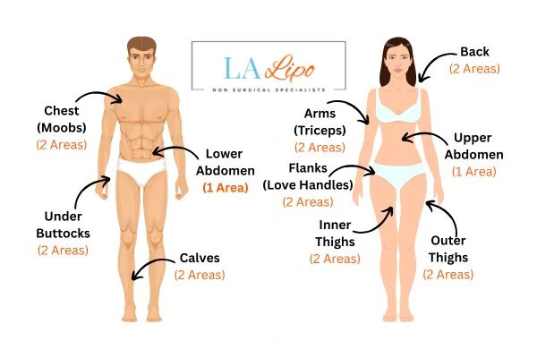 LA LIPO Cryolipolysis Areas Uttoxeter