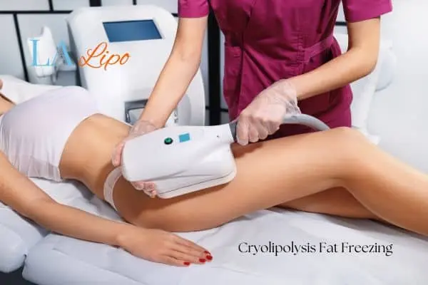 Woman receiving coolsculpting Uttoxeter treatment on her thighs