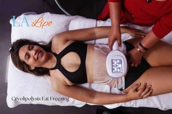 woman getting cryolipolysis Uttoxeter
