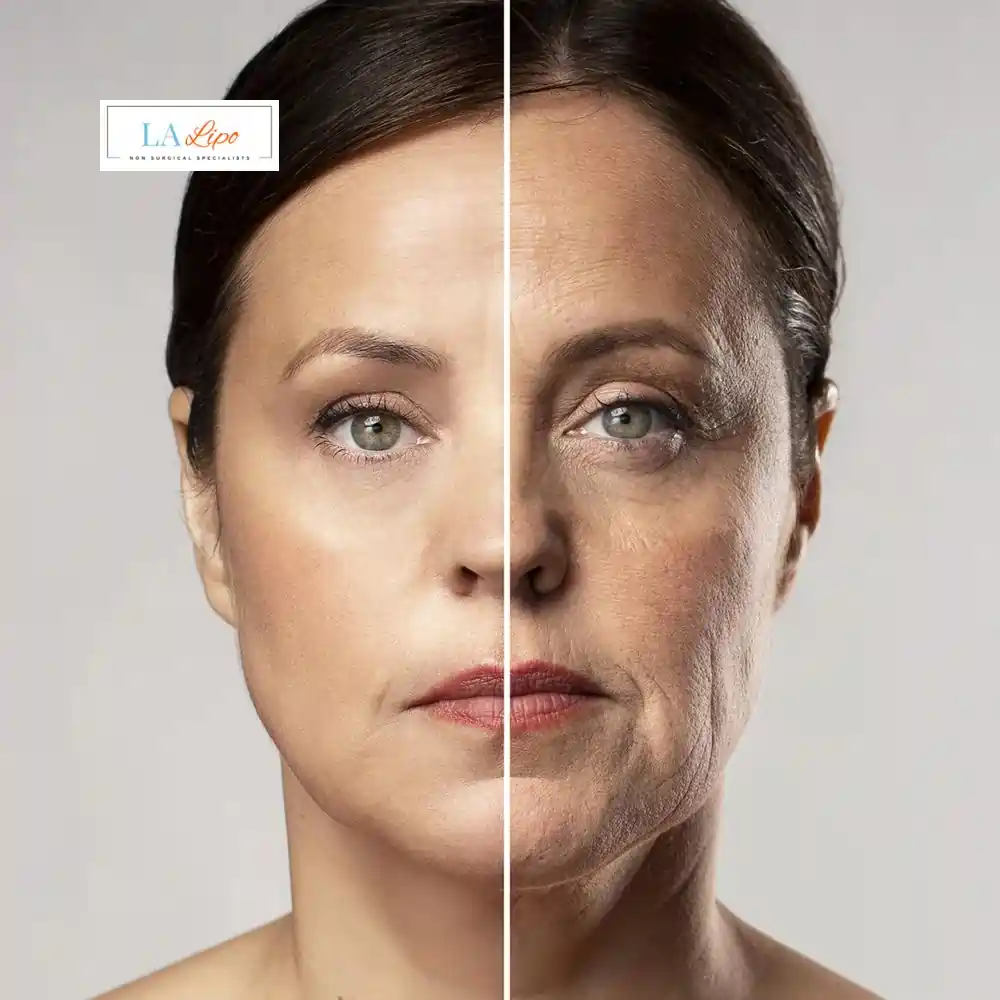 How Can You Tell If Non-Surgical Skin Tightening Is Right for You Uttoxeter?