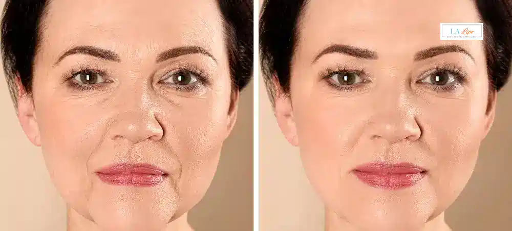 How Long Does It Take to See Results and How Long Do They Last Uttoxeter?