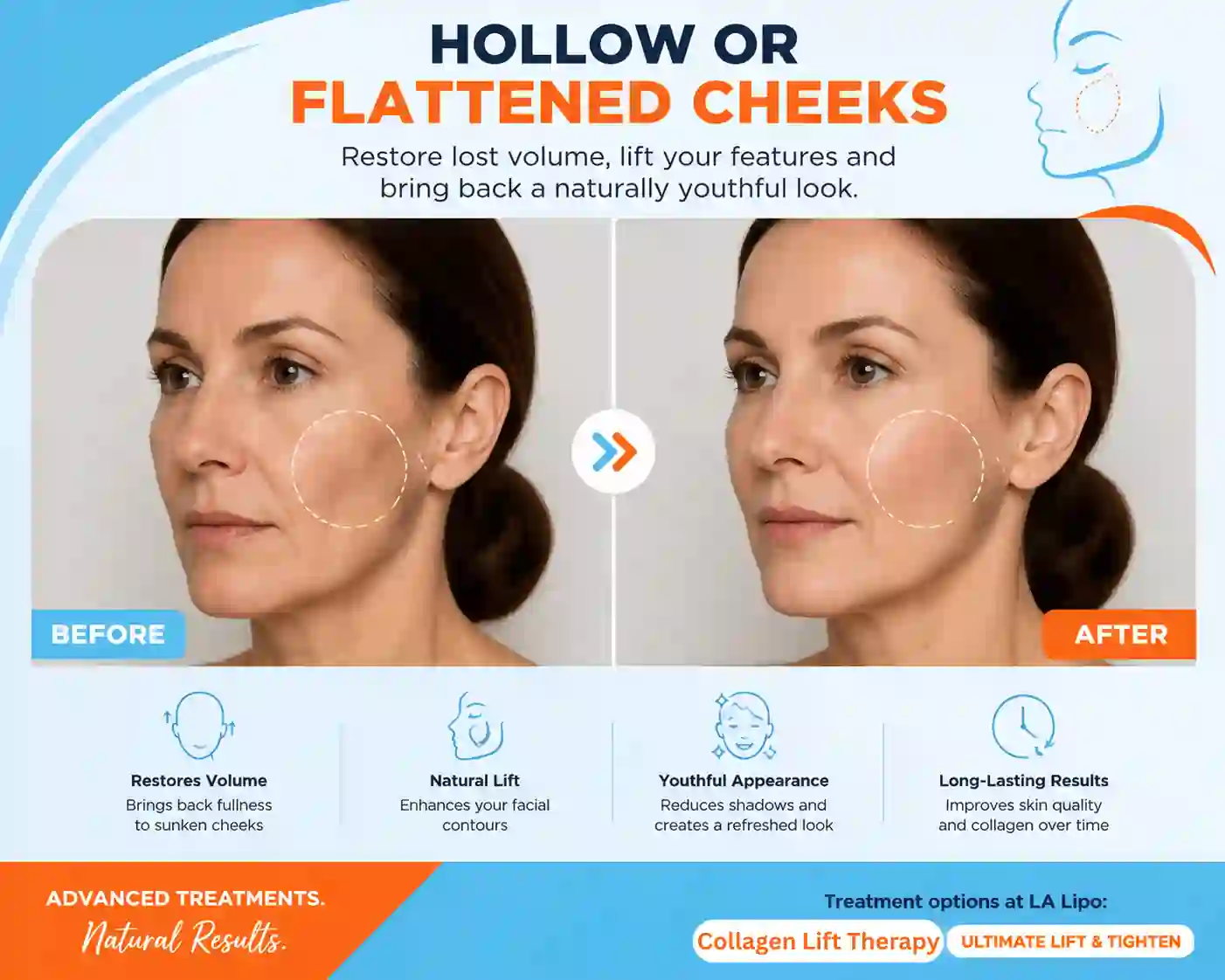 Sign #4: Hollow or Flattened Cheeks Uttoxeter