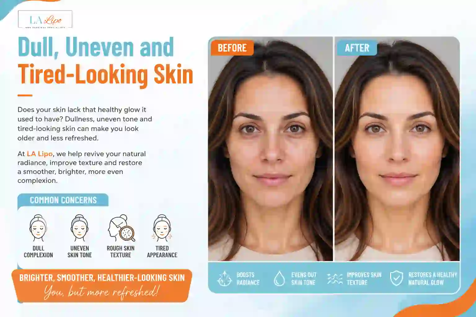 Sign #5: Dull, Uneven and Tired-Looking Skin Uttoxeter