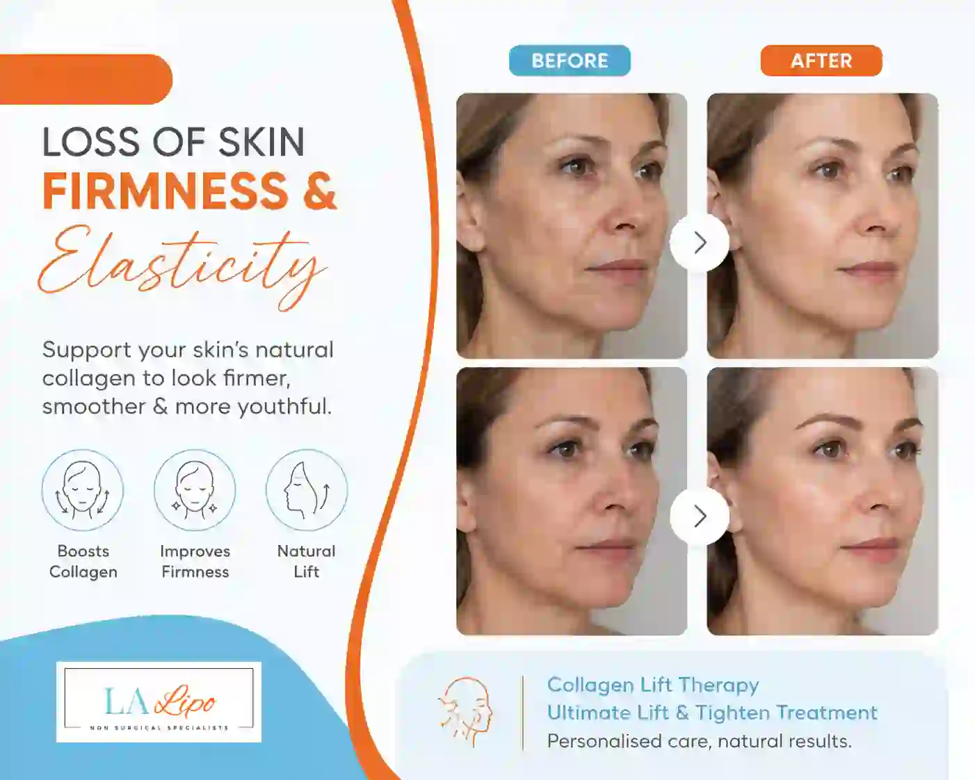 Sign #7: Loss of Skin Firmness and Elasticity Uttoxeter